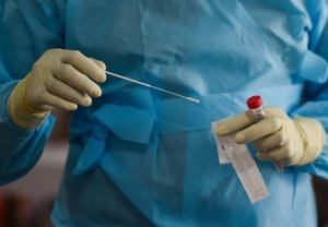 Swab Test